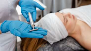 Microdermabrasion