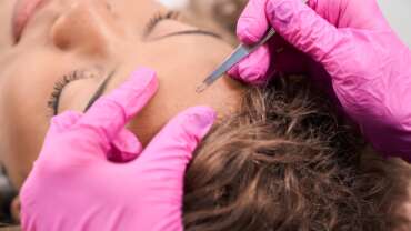 Dermaplaning